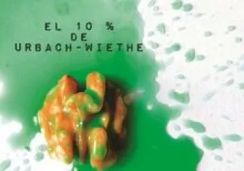 EL 10% DE URBACH-WIETHE en Madrid