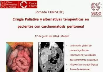 Jornada Cirugia Paliativa en Madrid