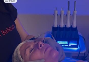 Biolifting con Guantes de Plata: Rejuvenecimiento Natural, Sin Agujas Madrid