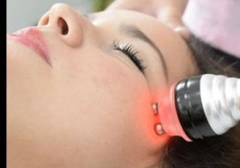 Tratamiento facial con Microdermoabrasión y Radiofrecuencia Madrid