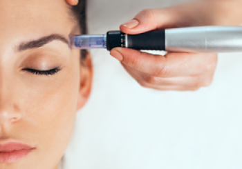 Tratamiento facial y ojeras, Dermapen médico y Eyes Peptides en Torrejón de Ardoz